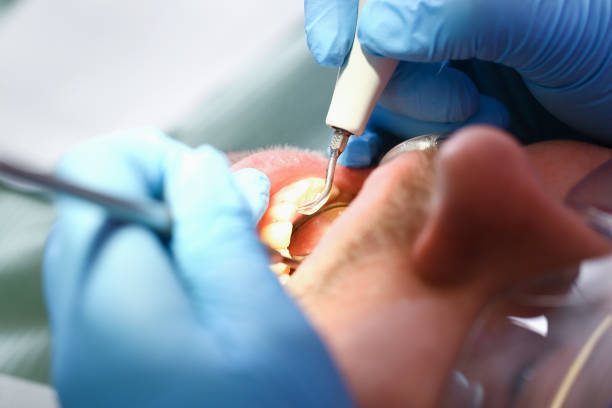 Best Knocked-Out Tooth Emergency  in Frankston, TX