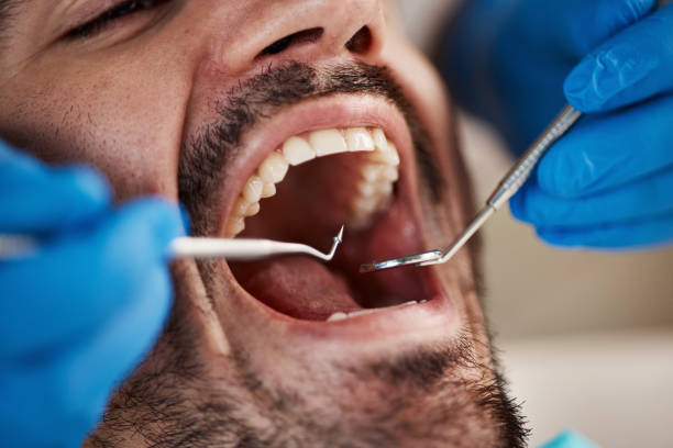 Best Dentist for Severe Toothache  in Frankston, TX